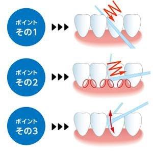 デンタルフロスの話し